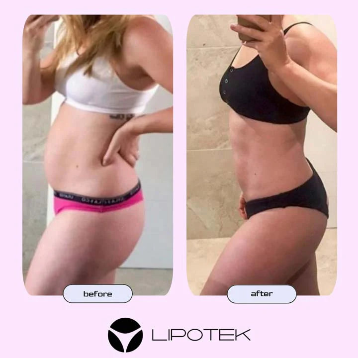 LIPO BELT™-Tvarujúci pás s technológiou EMS na zmiernenie bolesti krížov
