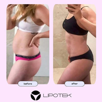 LIPO BELT™-Tvarujúci pás s technológiou EMS na zmiernenie bolesti krížov