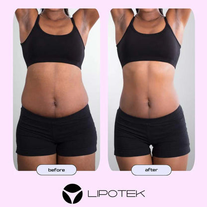 LIPO BELT™-Tvarujúci pás s technológiou EMS na zmiernenie bolesti krížov