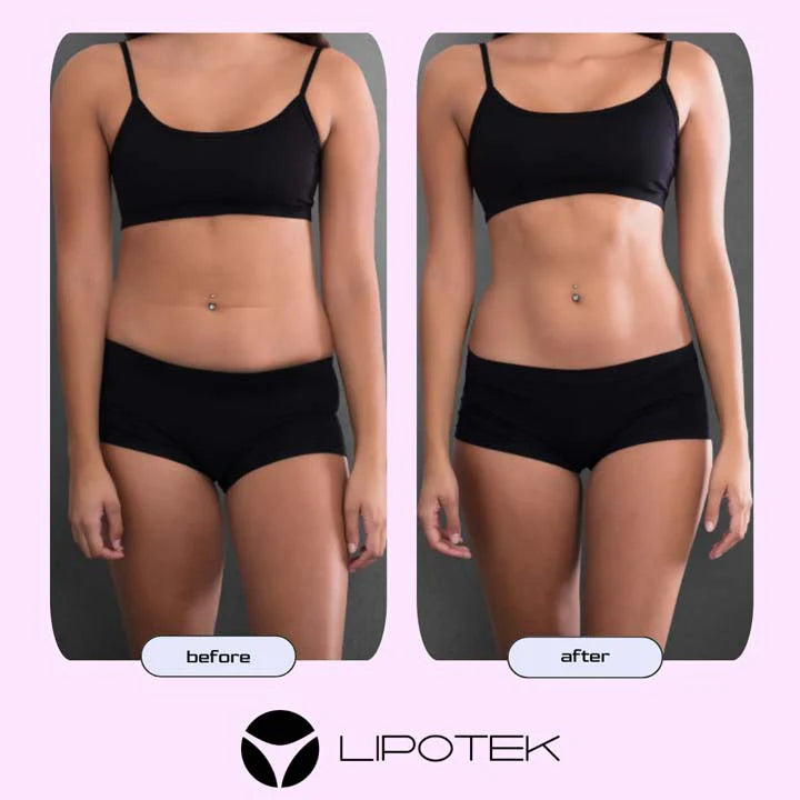 LIPO BELT™-Tvarujúci pás s technológiou EMS na zmiernenie bolesti krížov