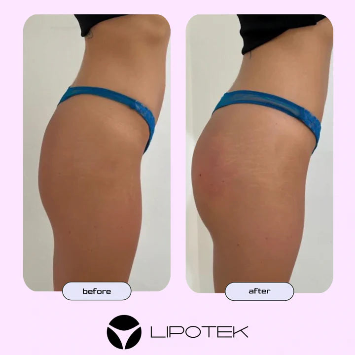 Liposhorts™ Vytvarujte si nohy a zadok