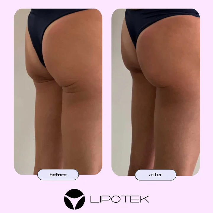 Liposhorts™ Vytvarujte si nohy a zadok