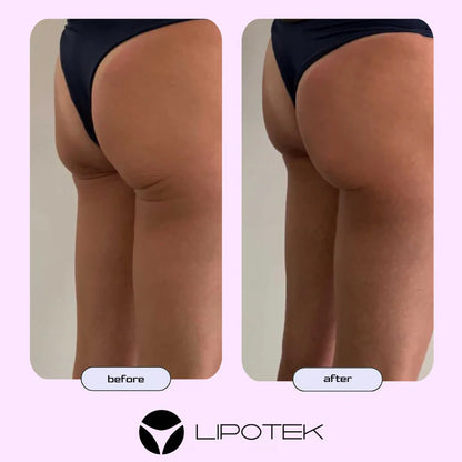 Liposhorts™ Vytvarujte si nohy a zadok